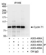 Cyclin T1 Antibody in Immunoprecipitation (IP)