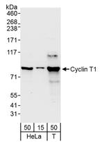 Cyclin T1 Antibody in Western Blot (WB)