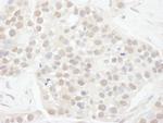 Cyclin T1 Antibody in Immunohistochemistry (Paraffin) (IHC (P))