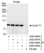 Cyclin T1 Antibody in Immunoprecipitation (IP)