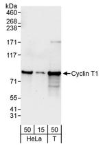 Cyclin T1 Antibody in Western Blot (WB)