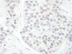 Cyclin T1 Antibody in Immunohistochemistry (Paraffin) (IHC (P))