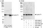 Cyclin T1 Antibody in Western Blot (WB)