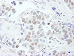 GATA3 Antibody in Immunohistochemistry (Paraffin) (IHC (P))