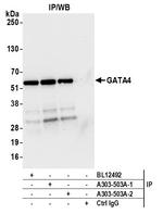 GATA4 Antibody in Immunoprecipitation (IP)