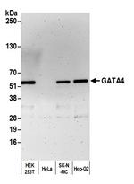 GATA4 Antibody in Western Blot (WB)