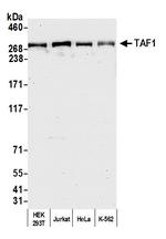 TAF1 Antibody in Western Blot (WB)