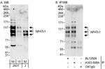 NFATc1 Antibody in Western Blot (WB)