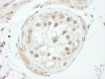 GTF2H1 Antibody in Immunohistochemistry (Paraffin) (IHC (P))