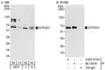 GTF2H1 Antibody in Western Blot (WB)