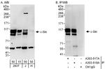 c-Ski Antibody in Western Blot (WB)