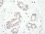 FOXC1 Antibody in Immunohistochemistry (Paraffin) (IHC (P))