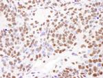 PABPN1 Antibody in Immunohistochemistry (Paraffin) (IHC (P))