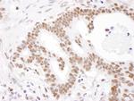 PABPN1 Antibody in Immunohistochemistry (Paraffin) (IHC (P))