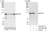 VPS11 Antibody in Western Blot (WB)