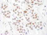 RAP1 Antibody in Immunohistochemistry (Paraffin) (IHC (P))