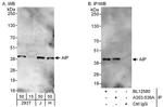 AIP Antibody in Western Blot (WB)