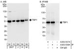 TBP1 Antibody in Western Blot (WB)