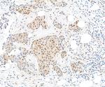 TBP1 Antibody in Immunohistochemistry (Paraffin) (IHC (P))