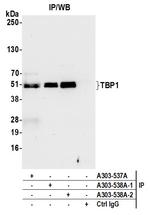 TBP1 Antibody in Immunoprecipitation (IP)