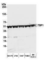 TBP1 Antibody in Western Blot (WB)