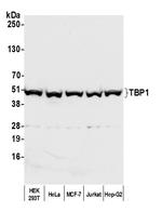 TBP1 Antibody in Western Blot (WB)