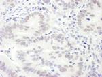 EDD1 Antibody in Immunohistochemistry (Paraffin) (IHC (P))