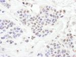 TLE1 Antibody in Immunohistochemistry (Paraffin) (IHC (P))