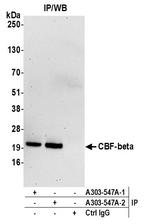 CBF-beta Antibody in Immunoprecipitation (IP)