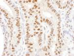 DACH1 Antibody in Immunohistochemistry (Paraffin) (IHC (P))