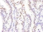 DACH1 Antibody in Immunohistochemistry (Paraffin) (IHC (P))