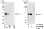 DACH1 Antibody in Western Blot (WB)