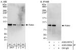 Kaiso Antibody in Western Blot (WB)