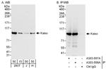 Kaiso Antibody in Western Blot (WB)