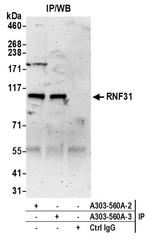 RNF31 Antibody in Immunoprecipitation (IP)