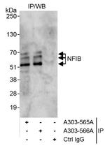 NFIB Antibody in Immunoprecipitation (IP)