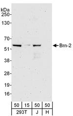 Brn-2 Antibody in Western Blot (WB)