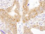 RPL6 Antibody in Immunohistochemistry (Paraffin) (IHC (P))