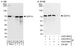 DCP1A Antibody in Western Blot (WB)