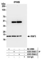 RNF5 Antibody in Immunoprecipitation (IP)