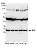 RNF5 Antibody in Western Blot (WB)