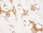 COX-2 Antibody in Immunohistochemistry (Paraffin) (IHC (P))