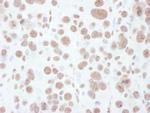 Phospho-MEK1 (Thr286) Antibody in Immunohistochemistry (Paraffin) (IHC (P))