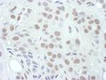 Phospho-MEK1 (Thr286) Antibody in Immunohistochemistry (Paraffin) (IHC (P))