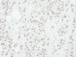 Phospho-MEK1 (Thr286) Antibody in Immunohistochemistry (Paraffin) (IHC (P))