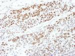 Phospho-MEK1 (Thr286) Antibody in Immunohistochemistry (Paraffin) (IHC (P))