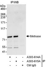 Metnase Antibody in Immunoprecipitation (IP)