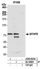 MTHFR Antibody in Immunoprecipitation (IP)