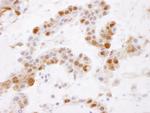 GSTP1 Antibody in Immunohistochemistry (Paraffin) (IHC (P))