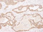 GSTP1 Antibody in Immunohistochemistry (Paraffin) (IHC (P))